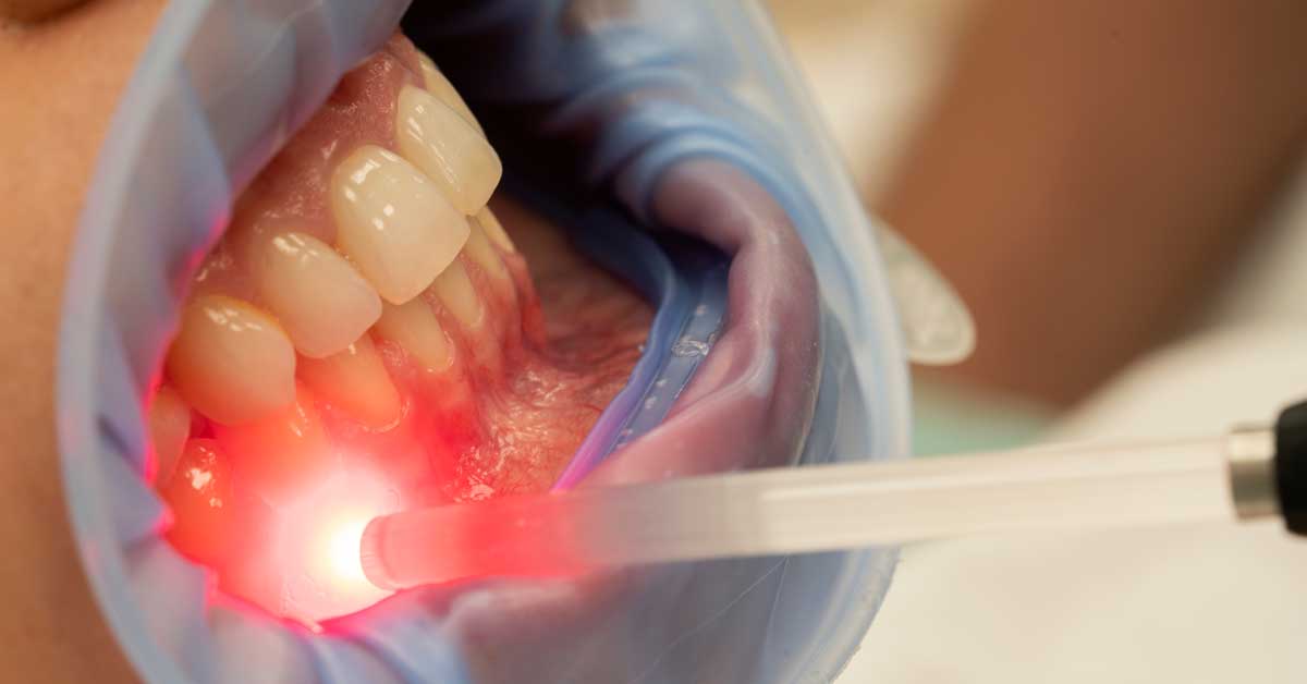 Can Red Light Therapy Regrow Gums
